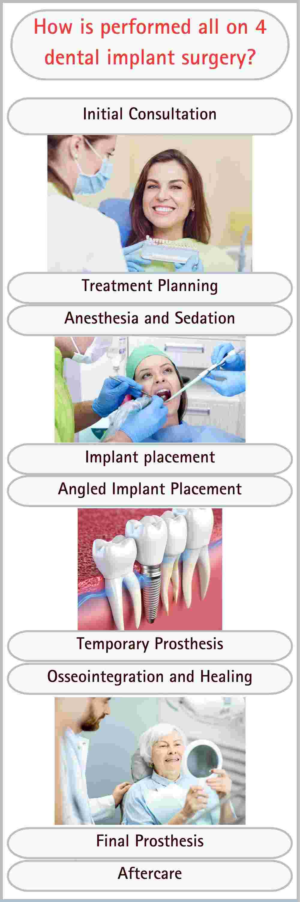 all-on-4 dental implants how is perfomed-turkey-antalya