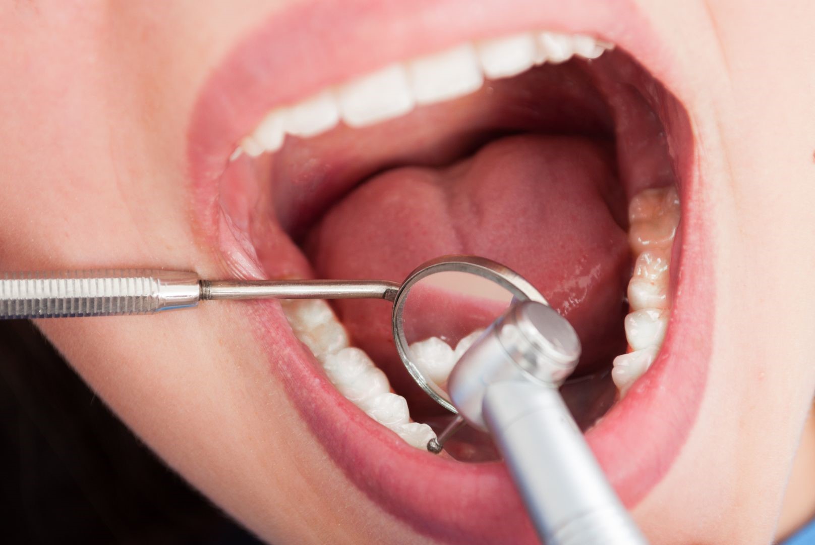 How to Heal Faster After Dental Implant Surgery-turkey